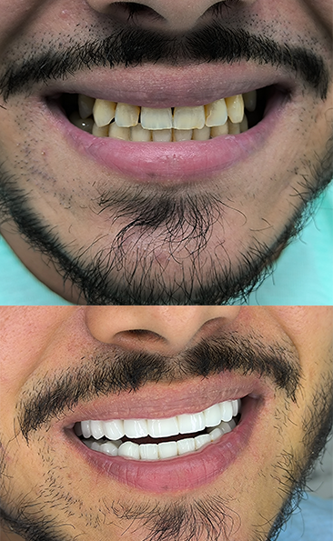 Transformacija osmeha